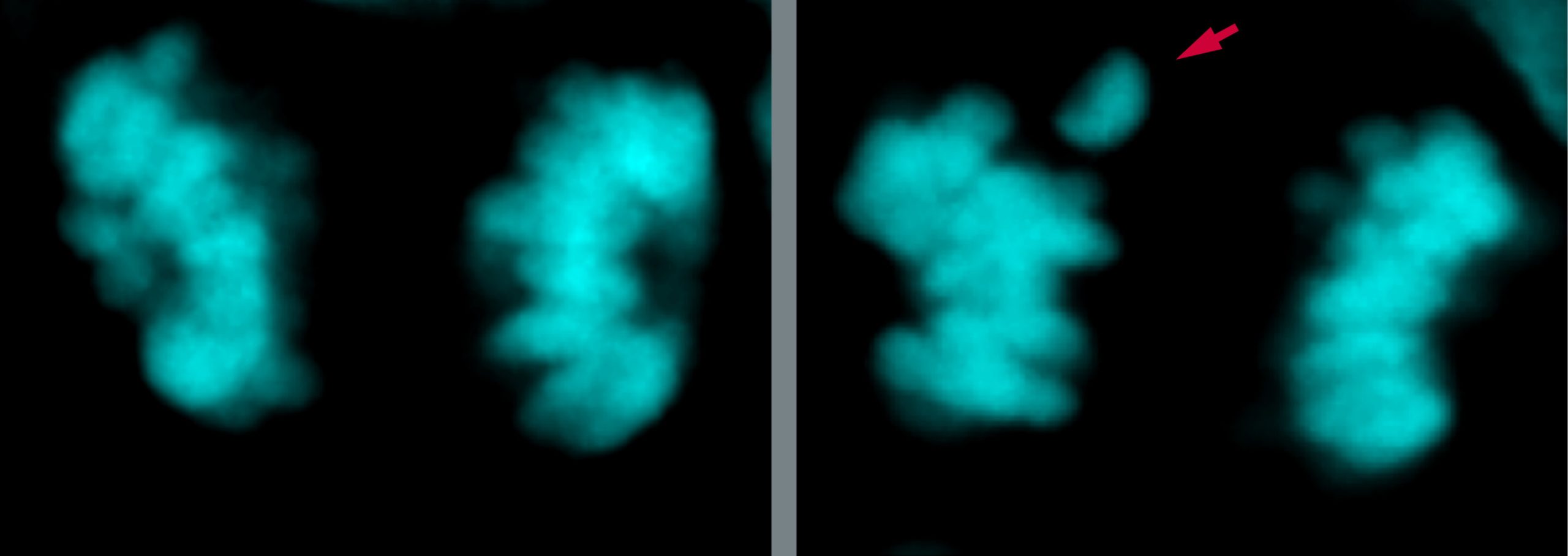 Taking your time makes a difference: Brain development differs between Neanderthals and modern humans

